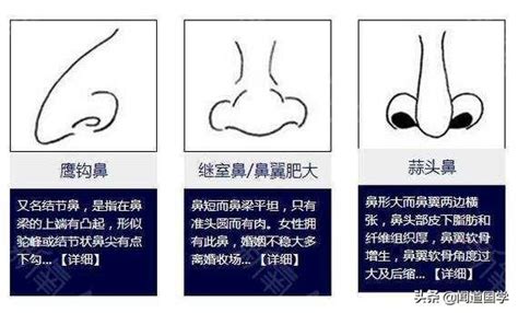 鼻相定富贵